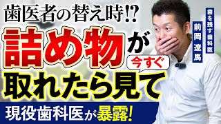 【有料級】歯の詰め物が取れた際に注意すべき６つのポイント【歯科医】
